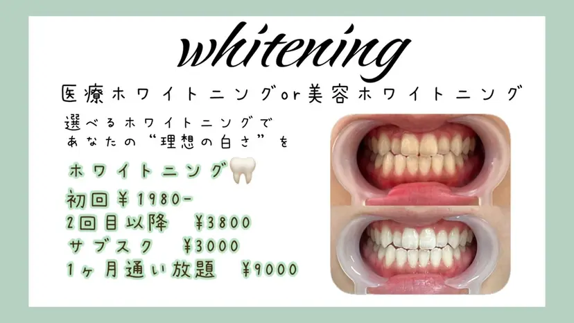 セルフホワイトニング 池袋 プラネットの掲載