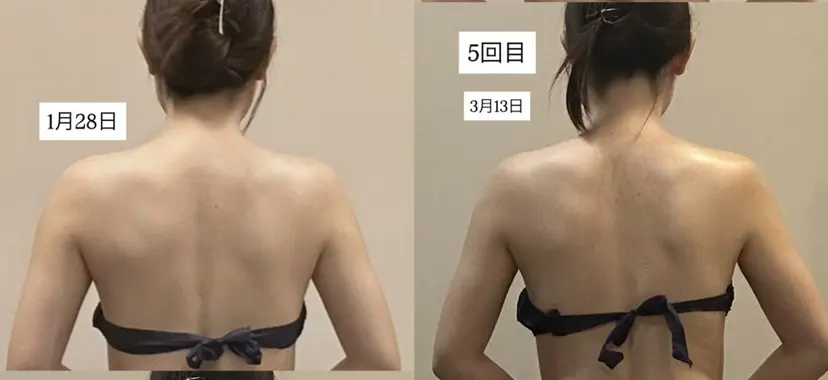 浮腫|肩こり|張り 日々の疲れを解消★の掲載