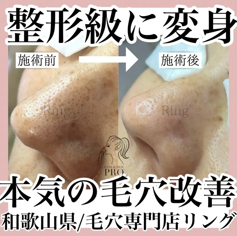 和歌山　毛穴専門店 Ringの掲載