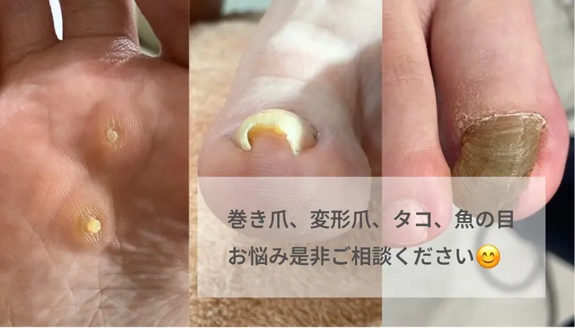 井上 愛梨の掲載