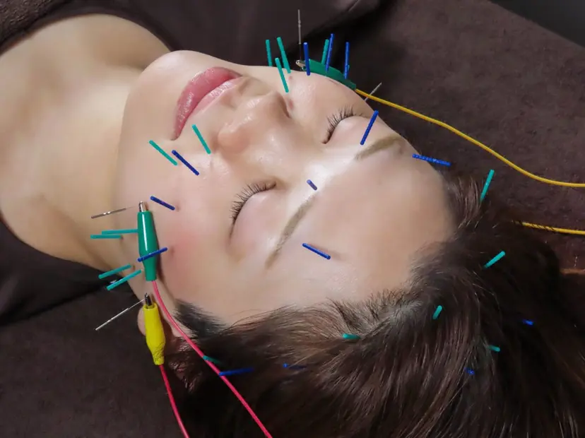 美容鍼×整体 KALONの掲載