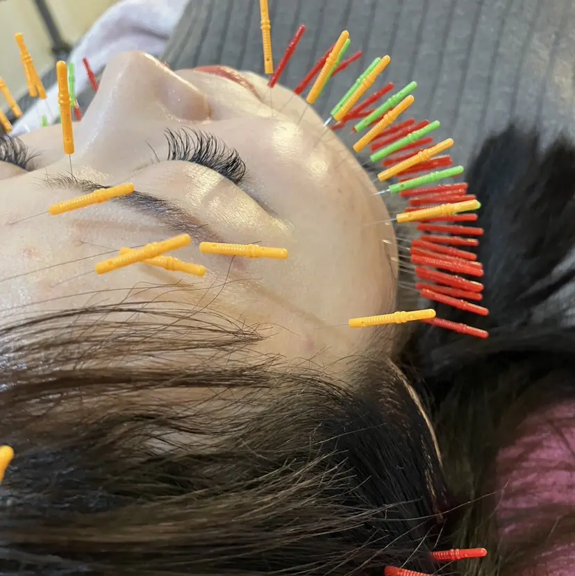 美容鍼灸女性専用 りんご鍼灸治療院の掲載