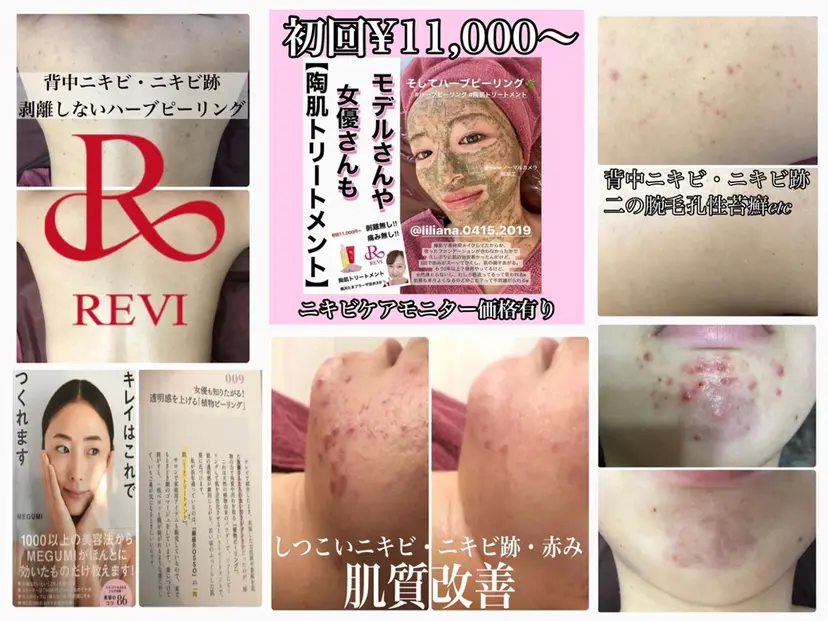 LILIANA ☆YURIの掲載