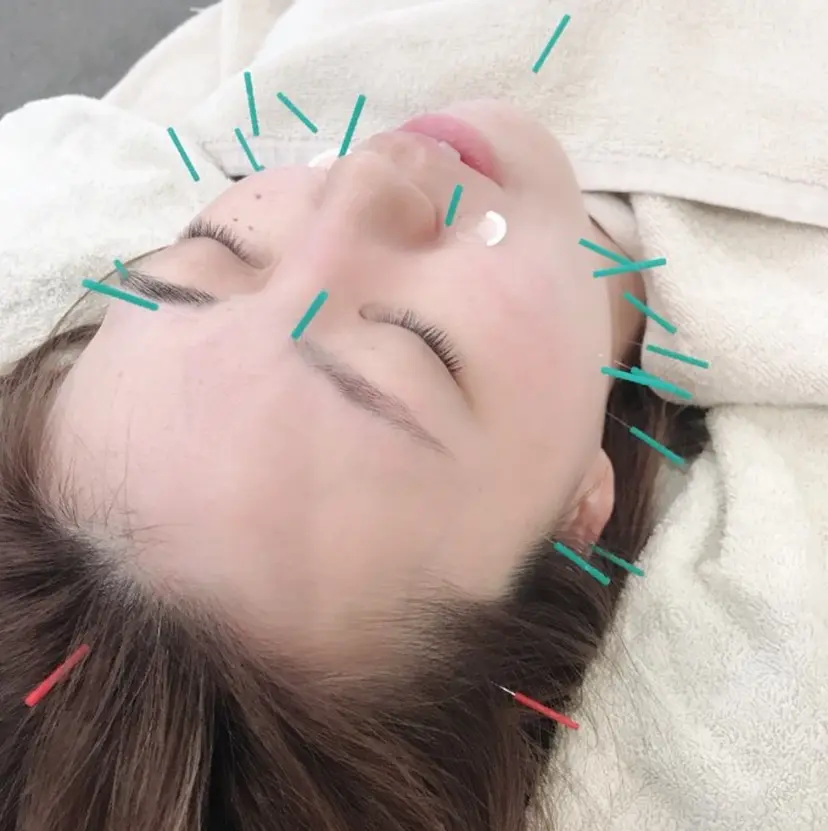 ヒロスポーツ鍼灸 整骨院（酒巻院長）の掲載