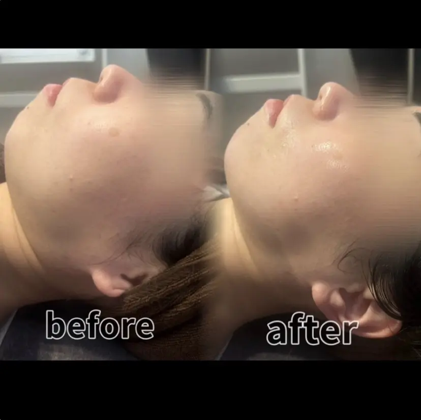 浮腫|肩こり|張り 日々の疲れを解消★の掲載