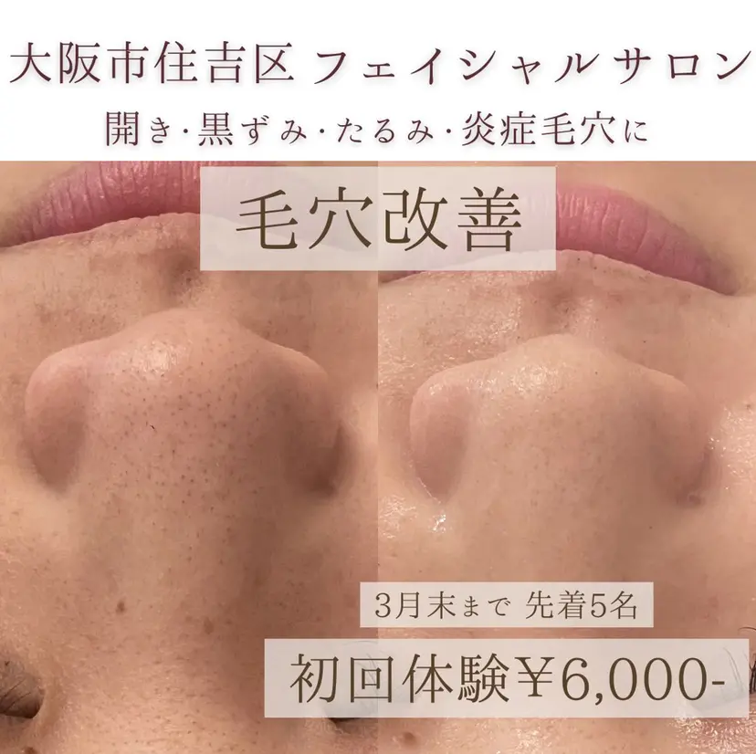 毛穴改善サロン d'Alba大阪住吉の掲載