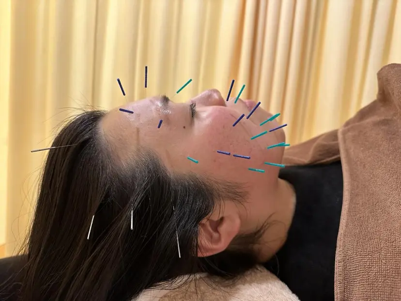 鍼灸サロン BBB3の掲載