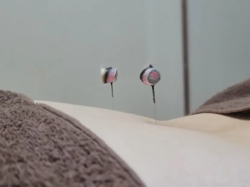 温活×自律神経  鍼灸Amaterasの掲載