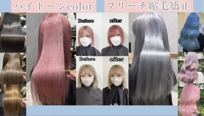 🩵ブリーチ矯正 HIDE🩵の掲載
