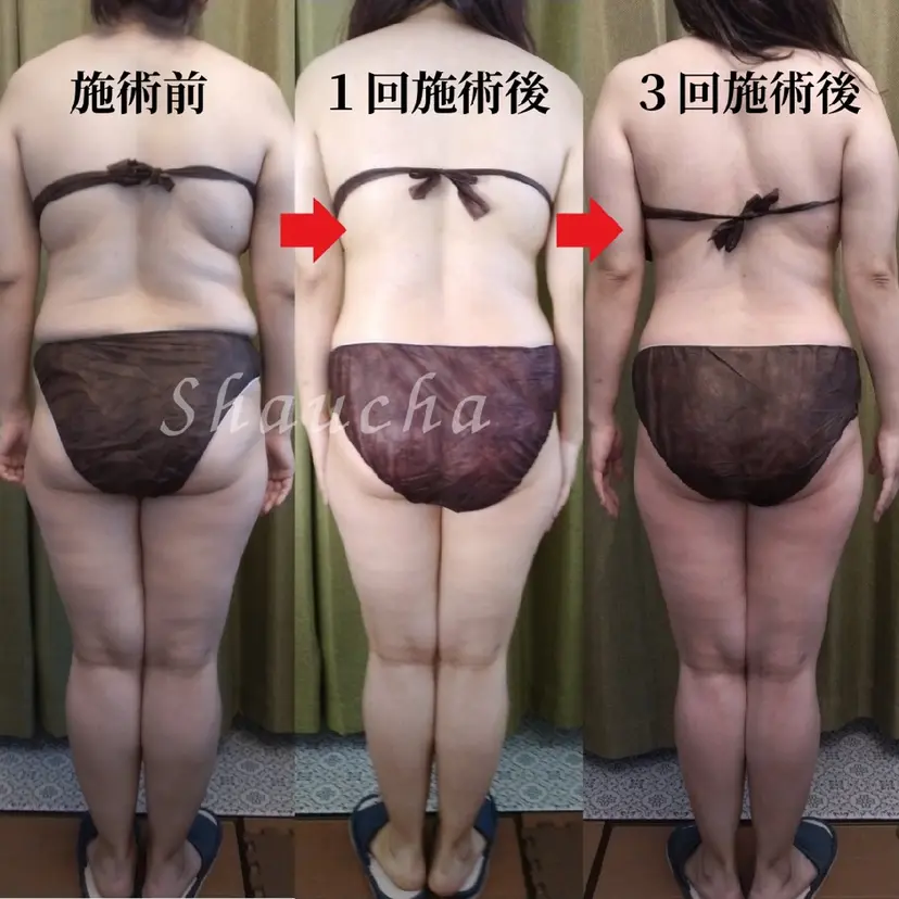 💎痩身エステサロン 💎シャウチャ奥多摩の掲載