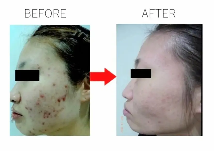 肌質改善専門サロン 川島 彩の掲載