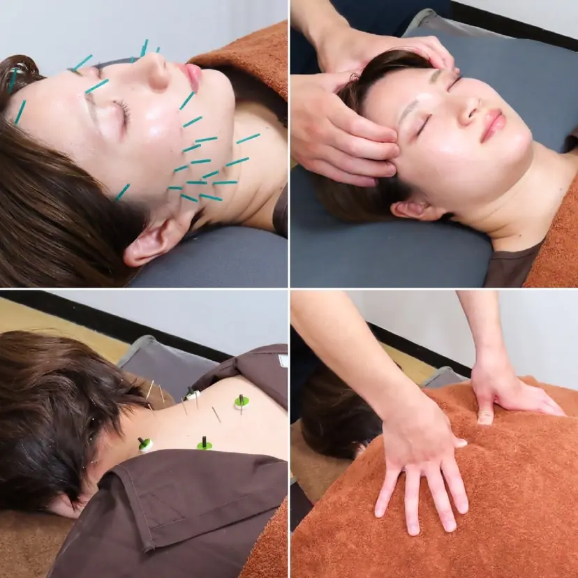 乃々鍼灸整体院 【美容鍼/整体】の掲載