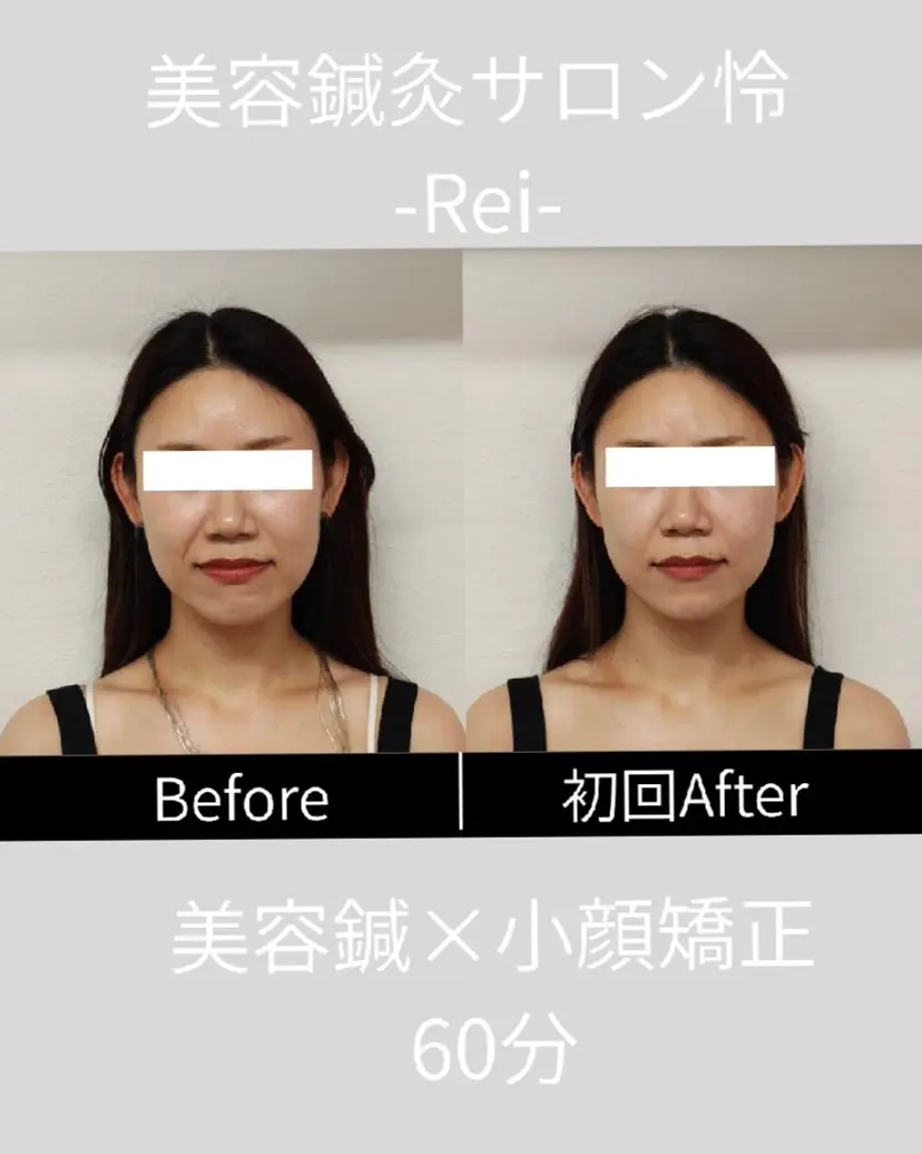 美容鍼灸サロン怜 -Rei-の掲載