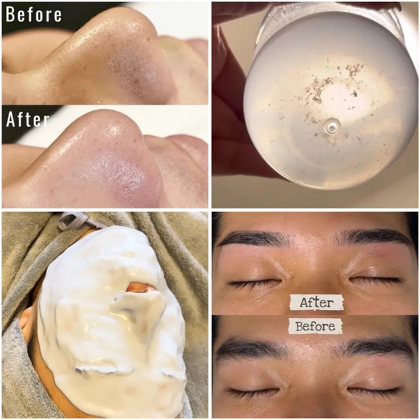 Anuenue 眉毛専用、毛穴洗浄の掲載