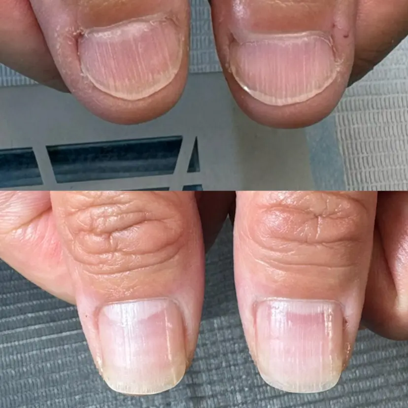 KIKOA NAIL キコアネイルの掲載