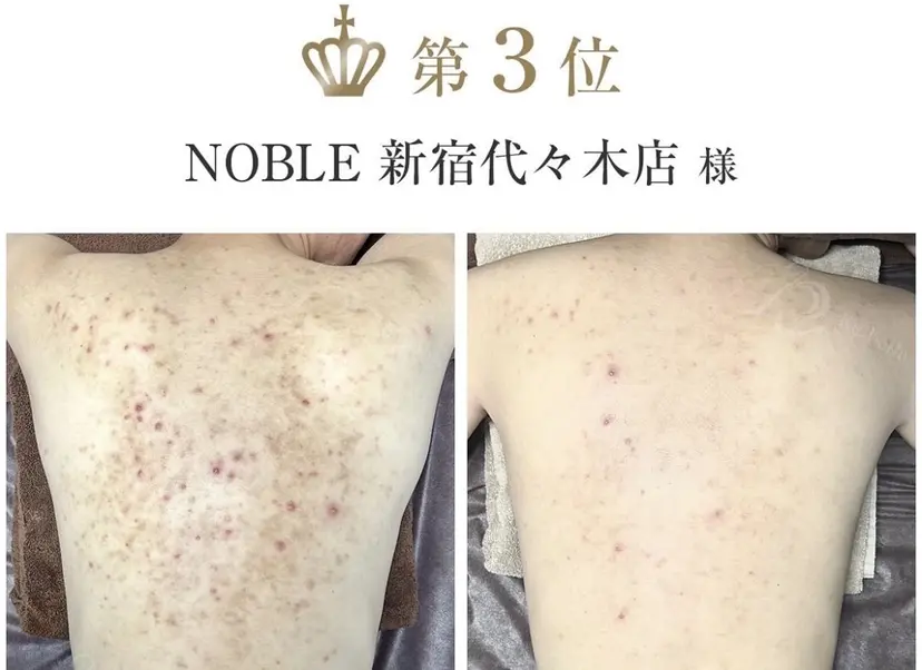 NOBLE 新宿南口店の掲載