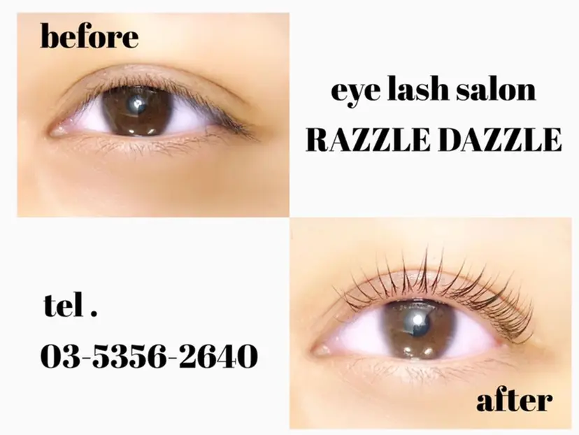 RAZZLE DAZZLEの掲載