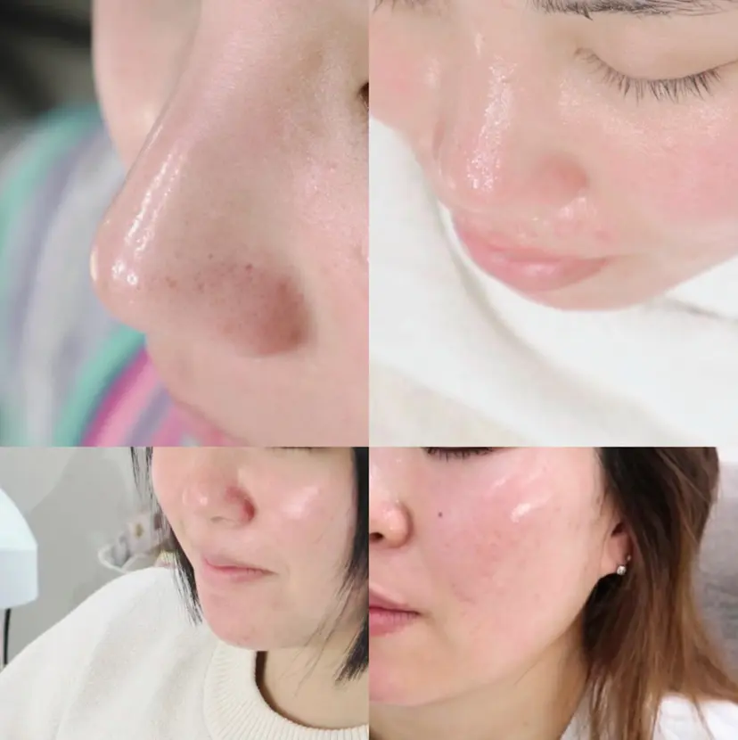 毛穴に特化したサロン MYFAIRLADYの掲載