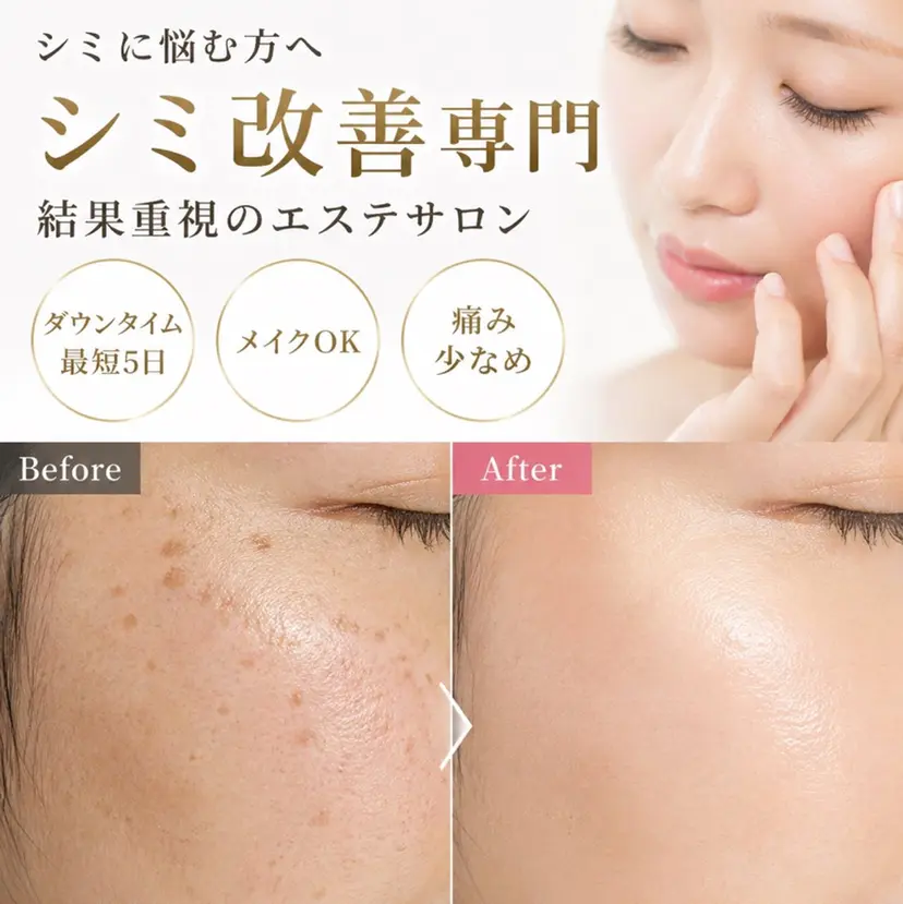 小顔とシミケア🪽 /Salon Mの掲載