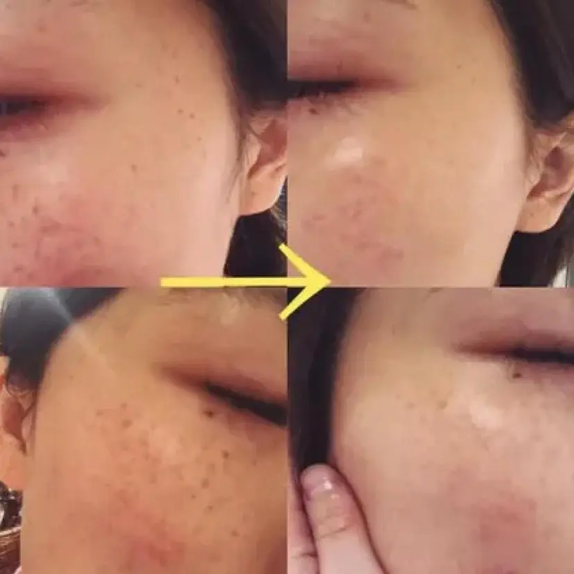 エステデ ビューティー佐々木の掲載