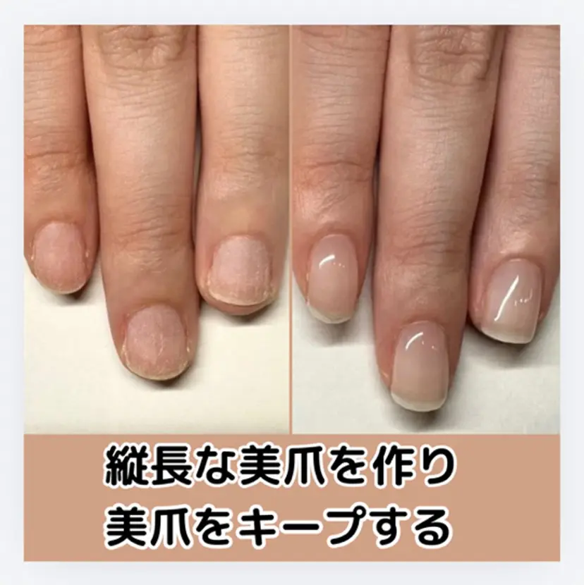 深爪矯正専門店 ネイルサロンKUUの掲載