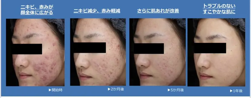 Rassurer 山本の掲載