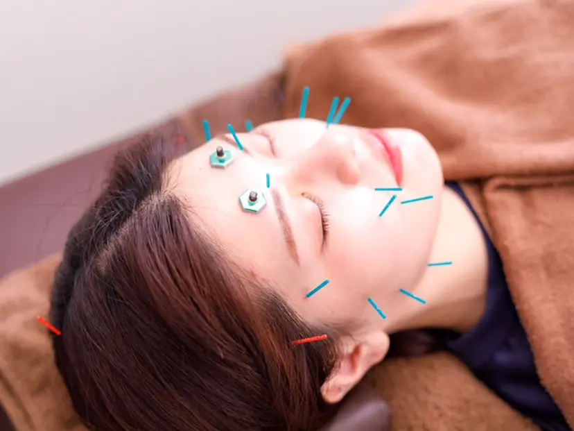 美容鍼灸整体サロン アネモネ 🌼林🌼の掲載
