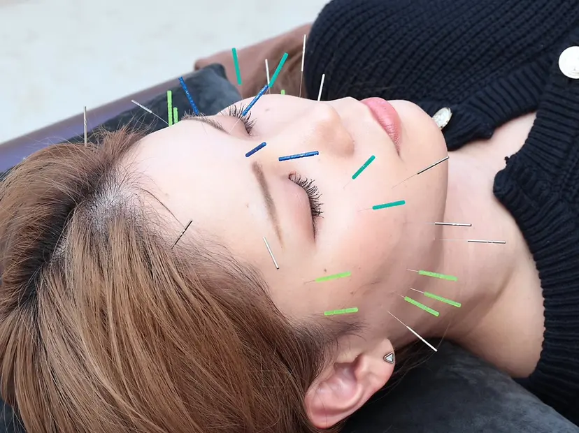 美容鍼・小顔矯正・ 整体/神戸 RYOの掲載