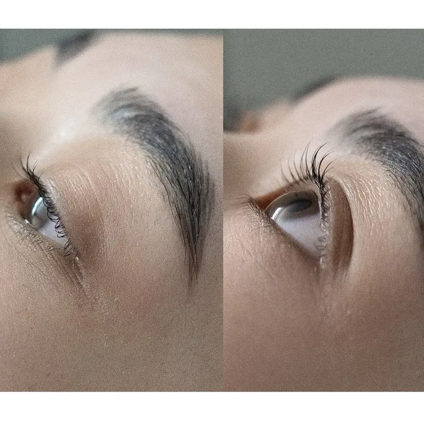 Öde eyeの掲載