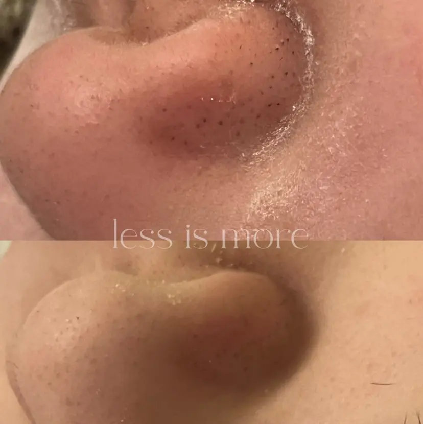 金の糸脱毛 産毛ケア専門の掲載