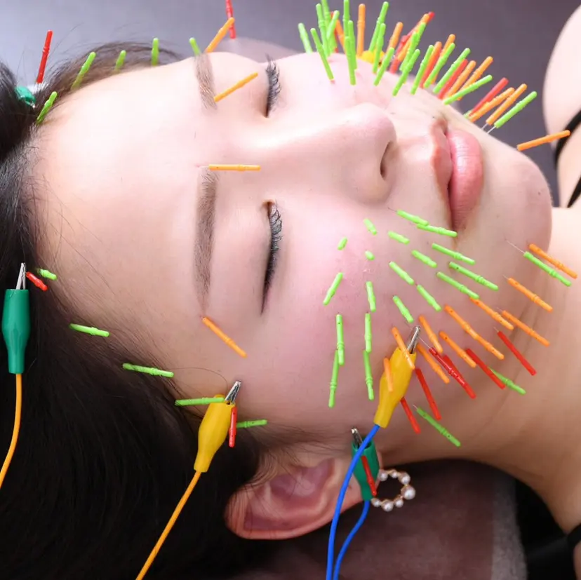 肌質改善×美容鍼 ゆいの掲載