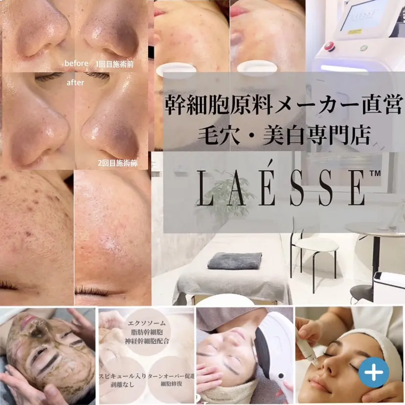 毛穴と美白の専門店 LAESSE 恵比寿の掲載
