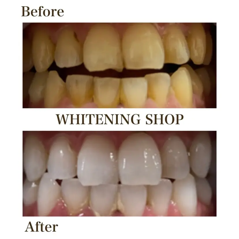 ホワイトニング ショップ 四条店の掲載