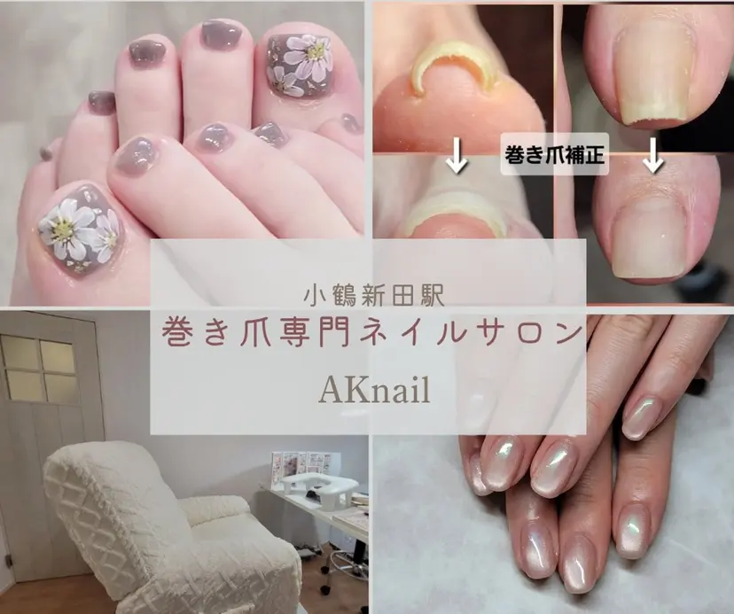 ネイル&巻き爪サロン AKnailの掲載