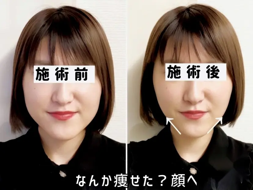 渋谷 小顔美容鍼 専門サロン YZの掲載