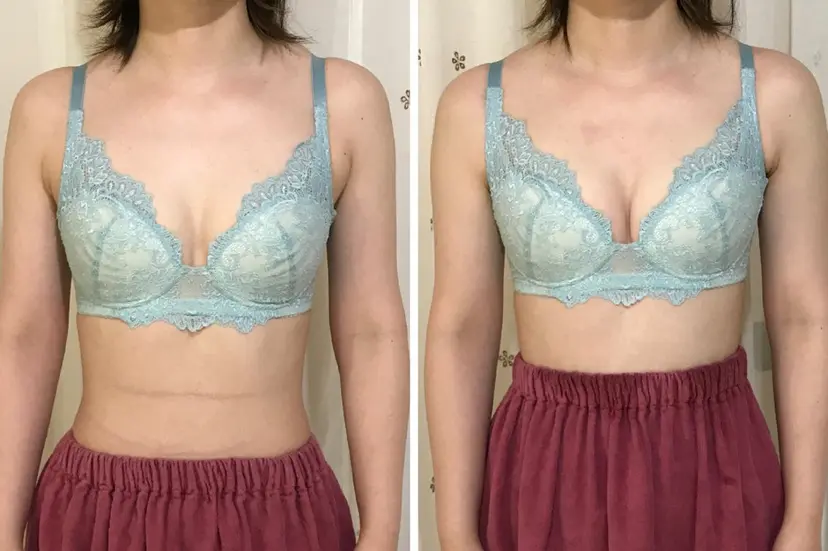 BETOWA  CHIKAの掲載