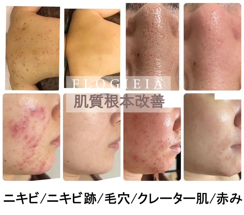 西田 まこの掲載