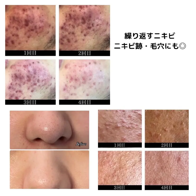 Beauty careの掲載