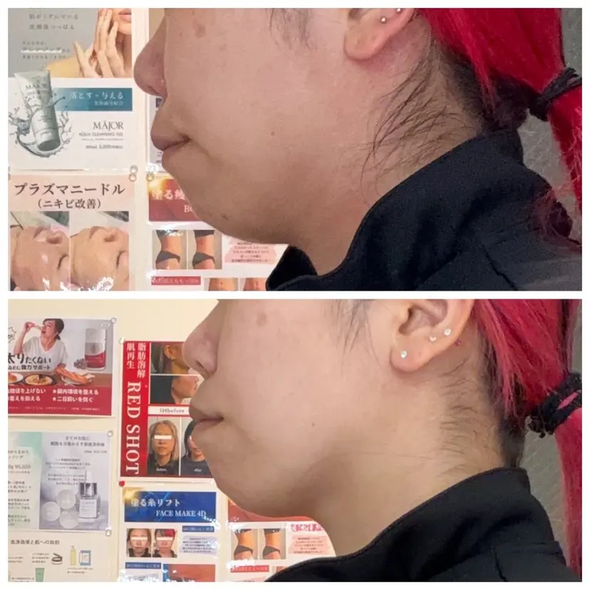 池田 桃花の掲載