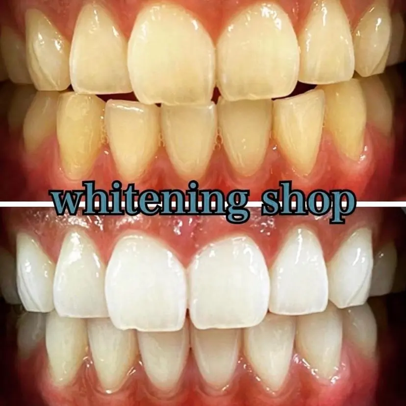 セルフ ホワイト ニングショップ立川の掲載