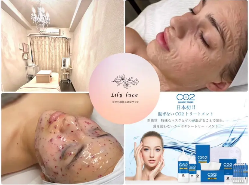 Lily luce 美骨小顔矯正の掲載