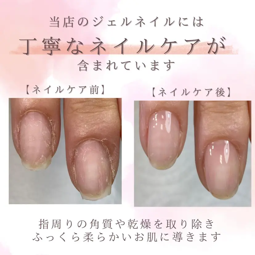 テテト *ネイルの掲載