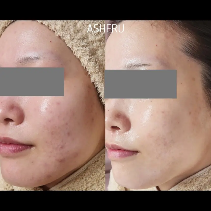 ASHERU* Yuiの掲載