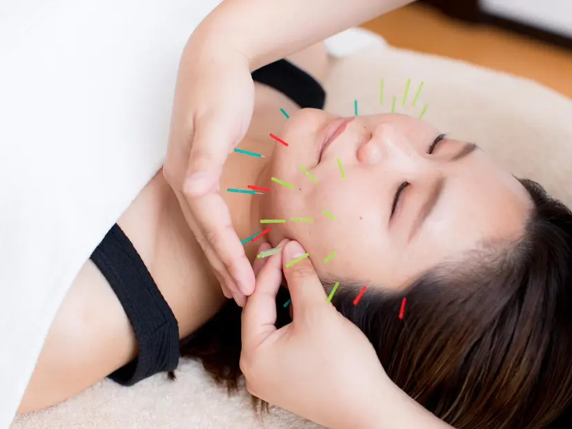 鍼灸サロン TIARA　美容鍼の掲載