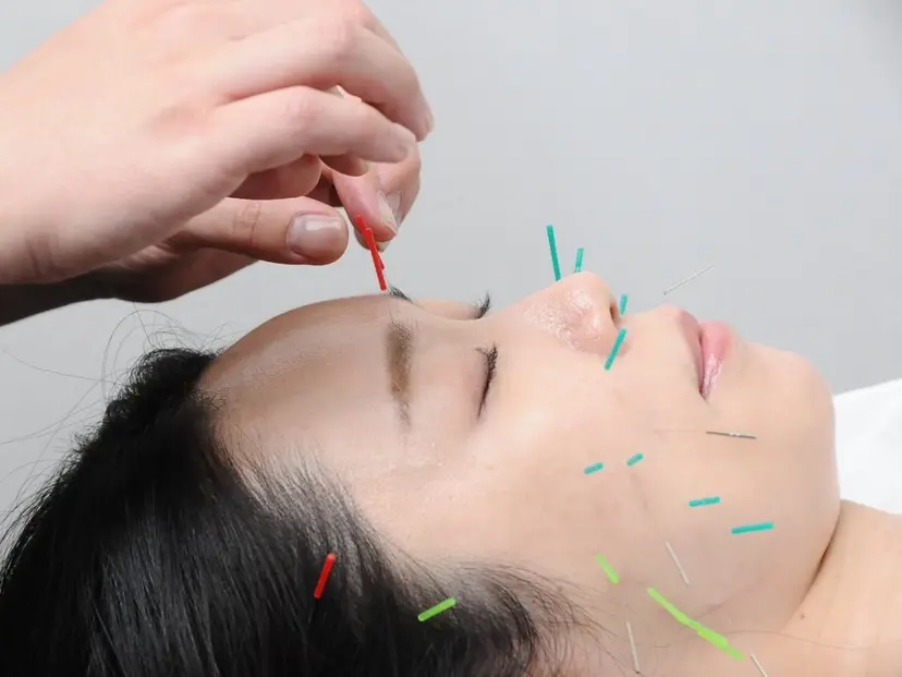 美容鍼・小顔矯正 FLOW 鍼灸整体院の掲載