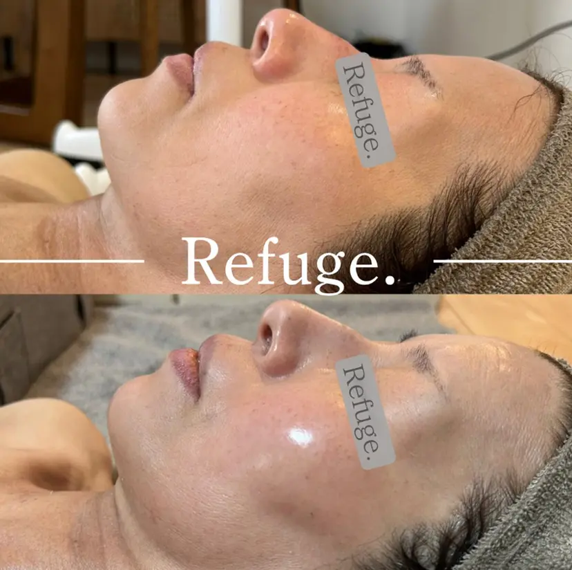 Refuge. (リフュージュ)の掲載