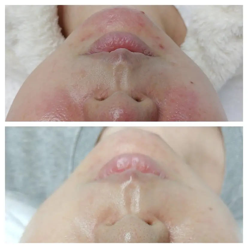 ロゼ ブランシュの掲載