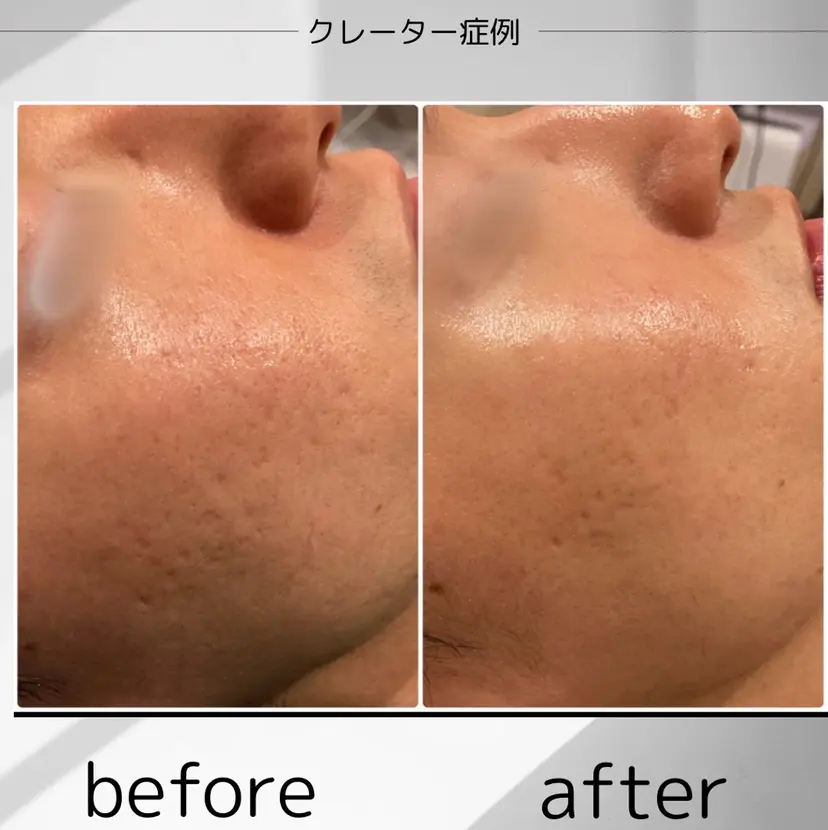 看護師が施術する美容 ナスサロ/☆田中☆の掲載