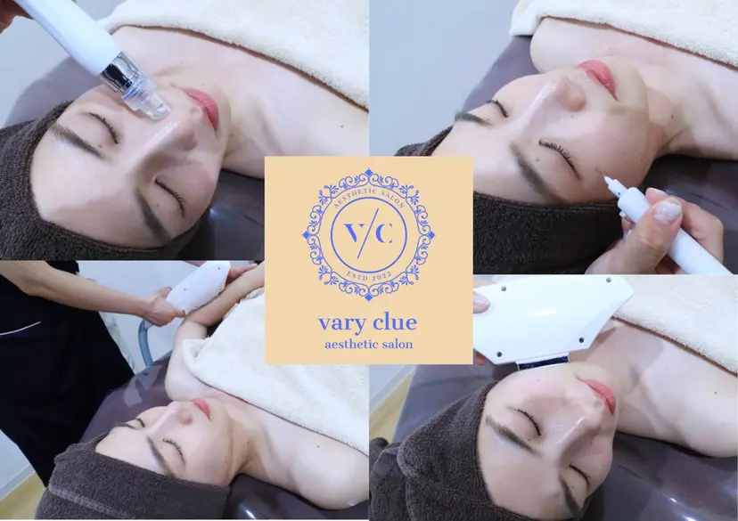 vary  clue MISAの掲載