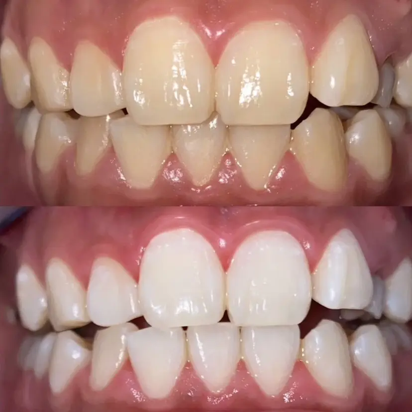 ホワイトニング ビューティー光の森店の掲載